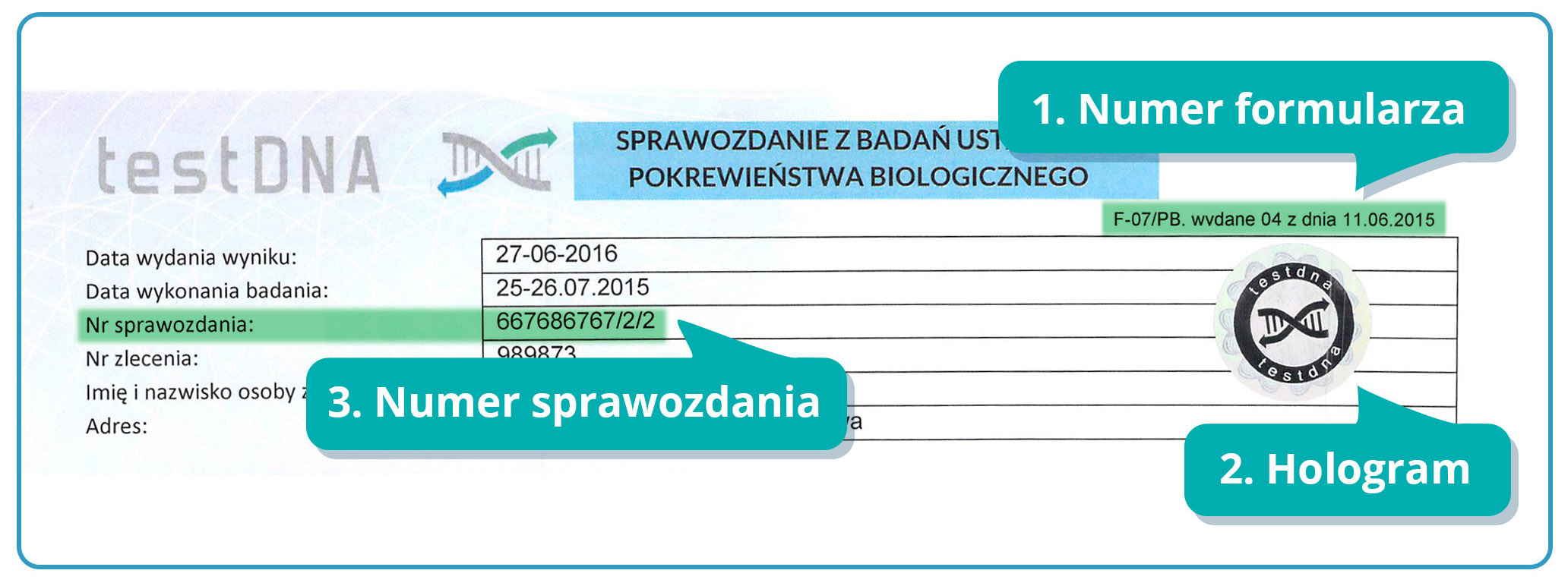 jak odczytać wynik testu na ojcostwo, jak odczytać wyniki badań genetycznych, wynik testu na ojcostwo