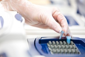 Reakcja PCR